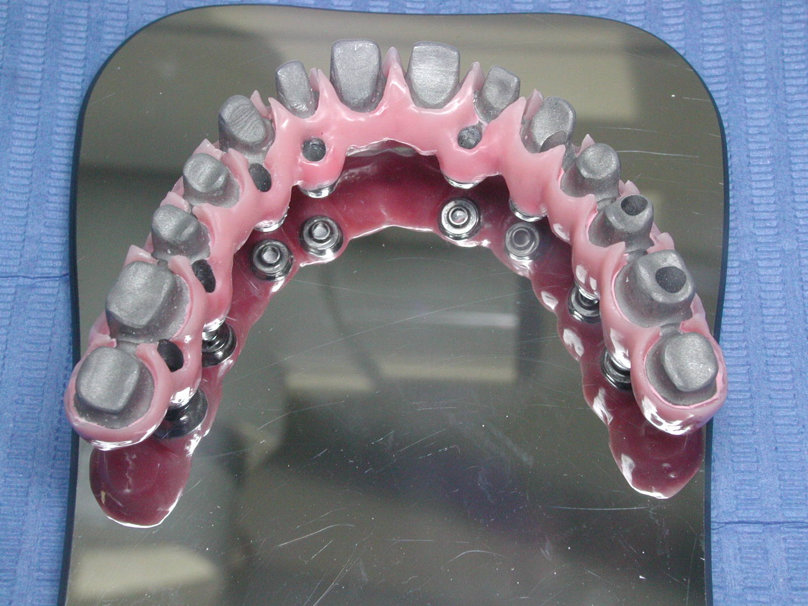 https://clinique-dentaire-solesmes.com/wp-content/uploads/2019/11/implants-10.jpg