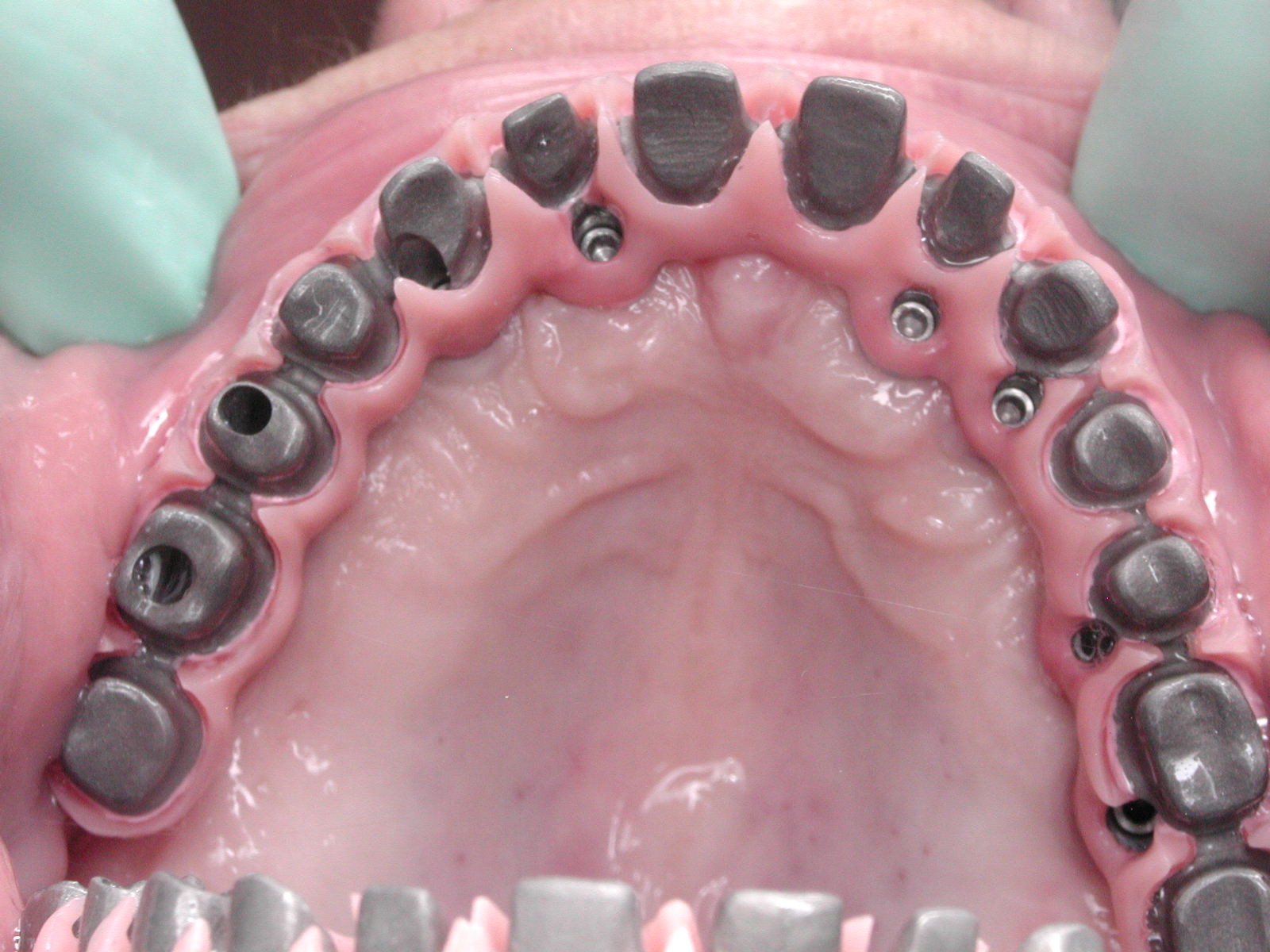 https://clinique-dentaire-solesmes.com/wp-content/uploads/2019/11/implants-11.jpg