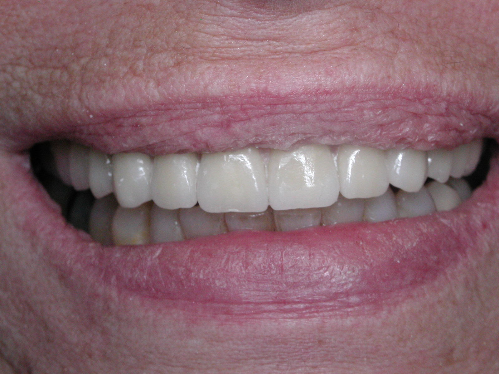 https://clinique-dentaire-solesmes.com/wp-content/uploads/2019/11/implants-13.jpg