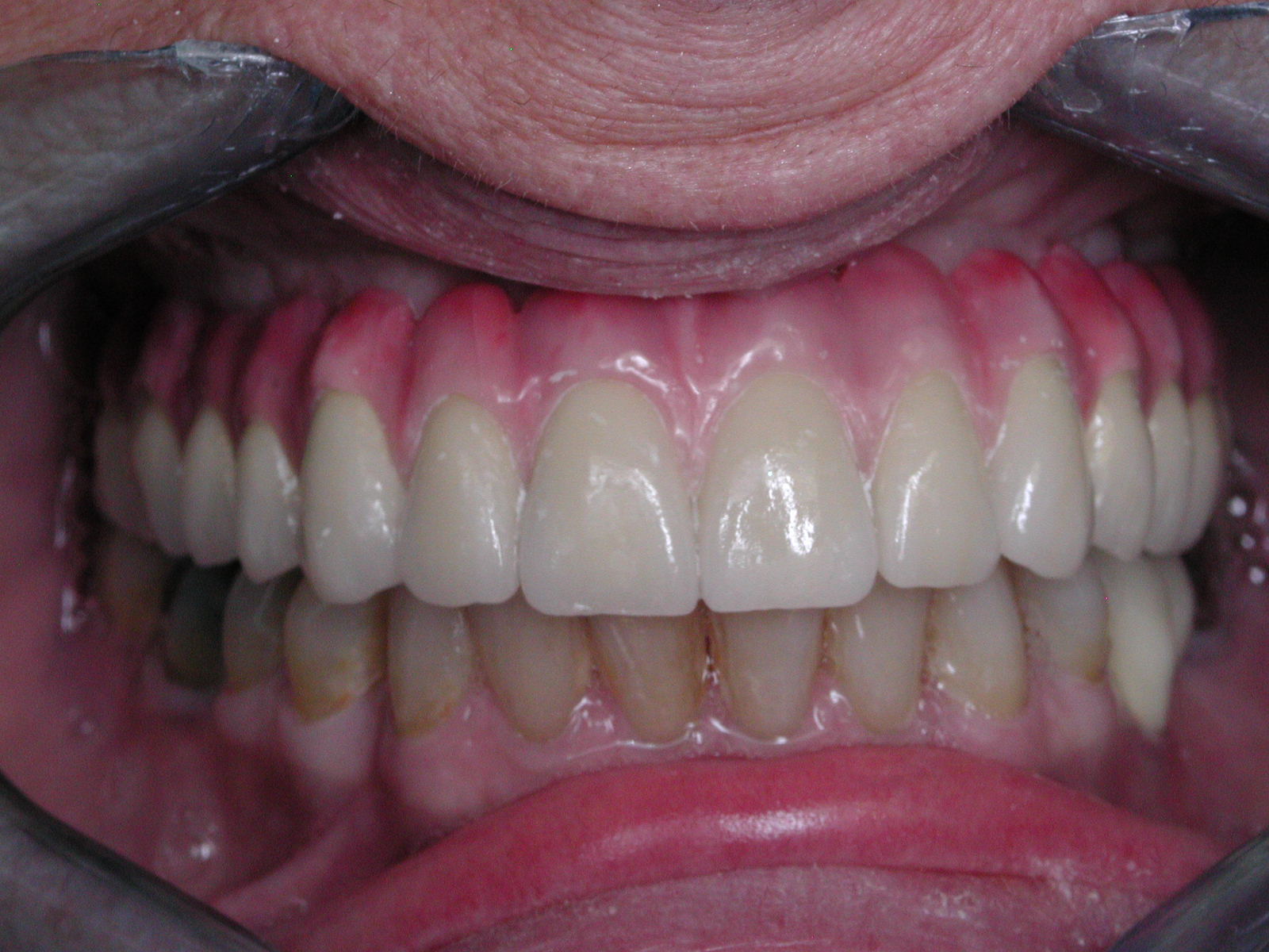 https://clinique-dentaire-solesmes.com/wp-content/uploads/2019/11/implants-14.jpg