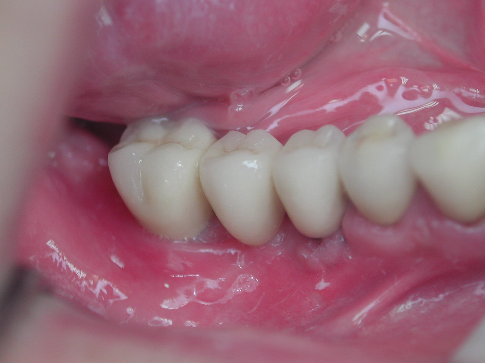 https://clinique-dentaire-solesmes.com/wp-content/uploads/2019/11/implants-18.jpg