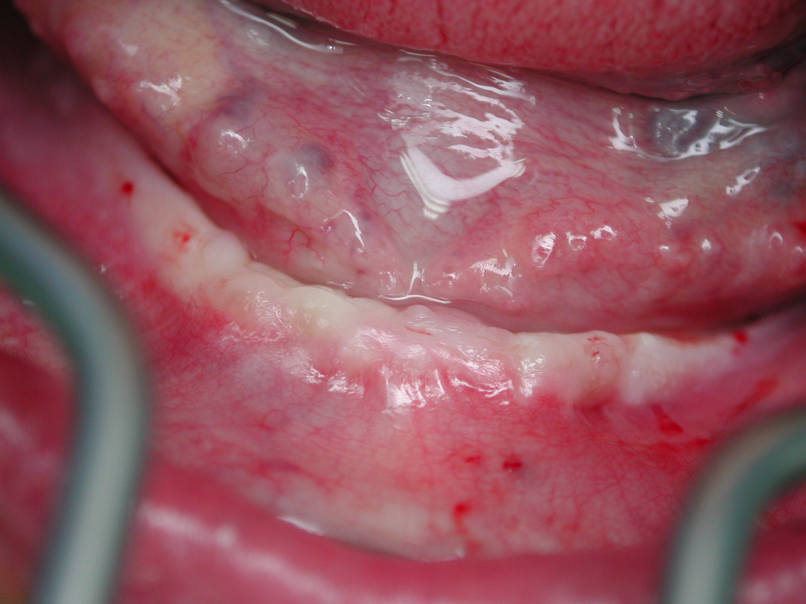 https://clinique-dentaire-solesmes.com/wp-content/uploads/2019/11/implants-3.jpg