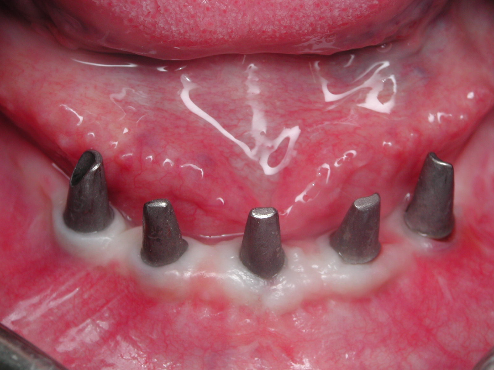 https://clinique-dentaire-solesmes.com/wp-content/uploads/2019/11/implants-5.jpg