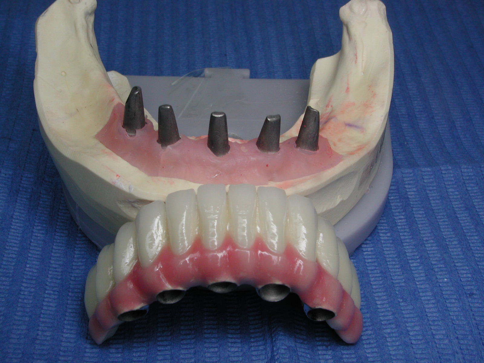 https://clinique-dentaire-solesmes.com/wp-content/uploads/2019/11/implants-6.jpg