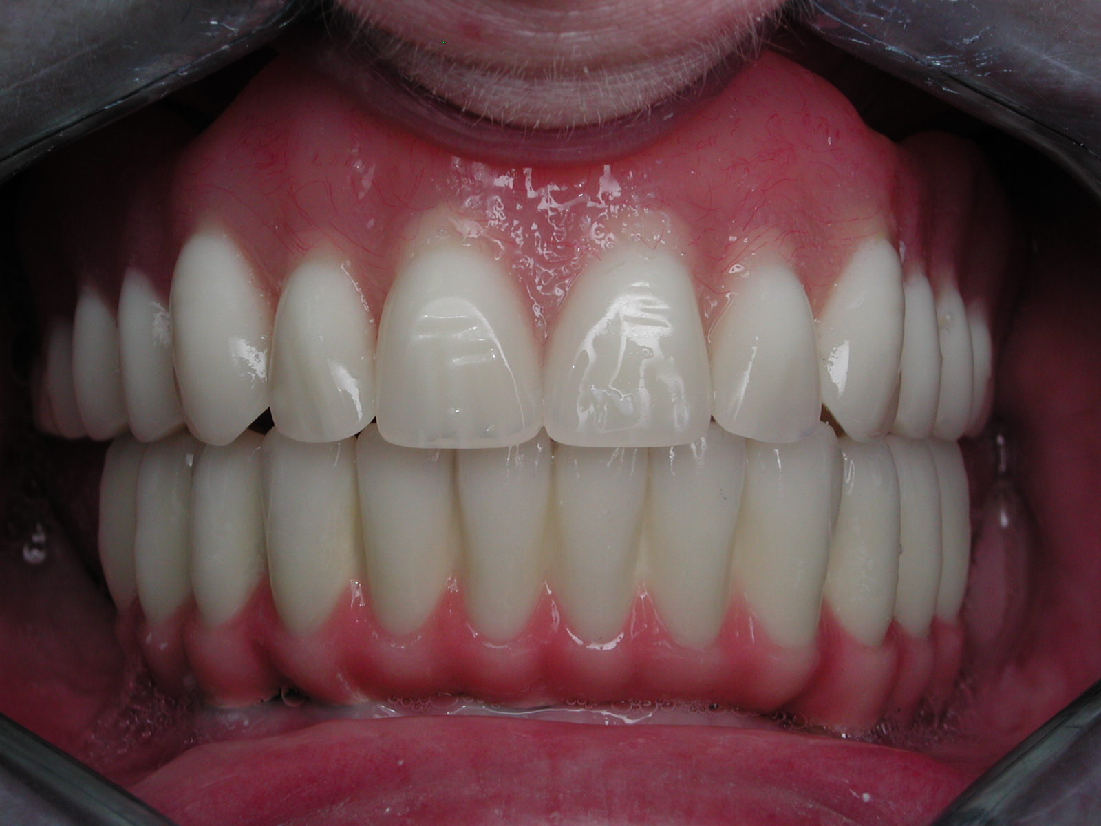 https://clinique-dentaire-solesmes.com/wp-content/uploads/2019/11/implants-7.jpg