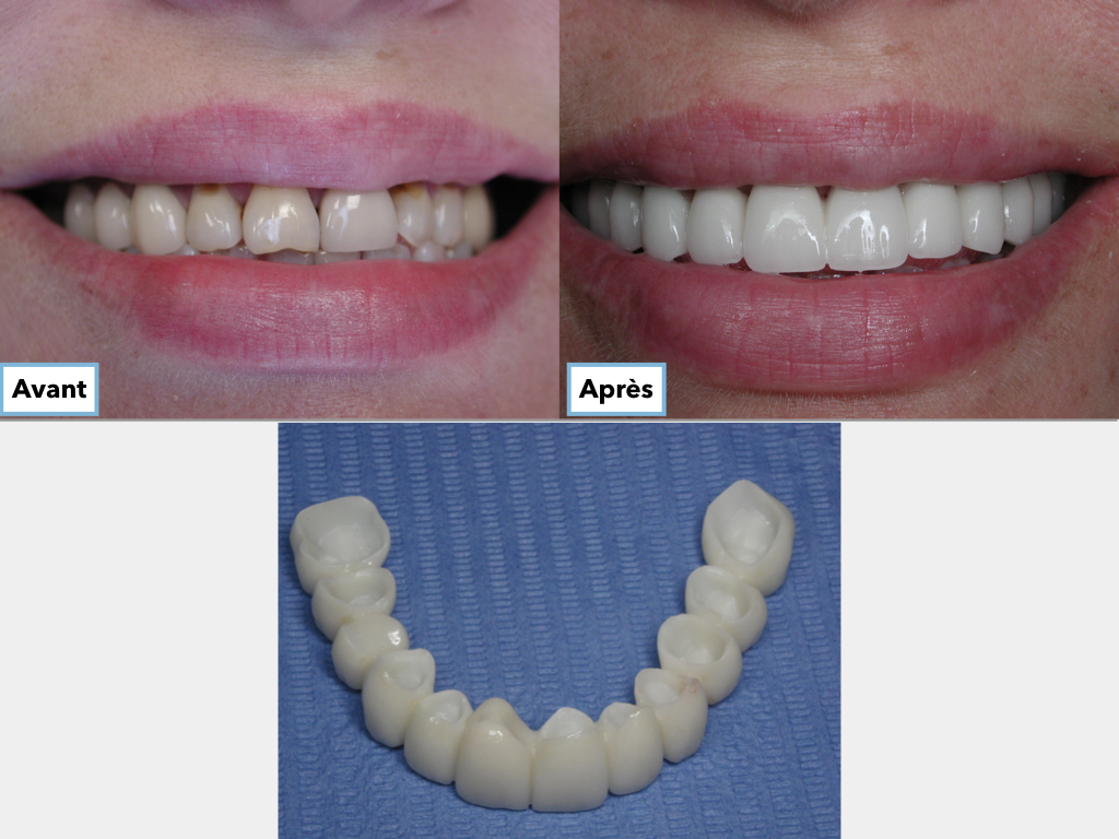https://clinique-dentaire-solesmes.com/wp-content/uploads/2019/11/un-nouveau-sourire.001.jpeg