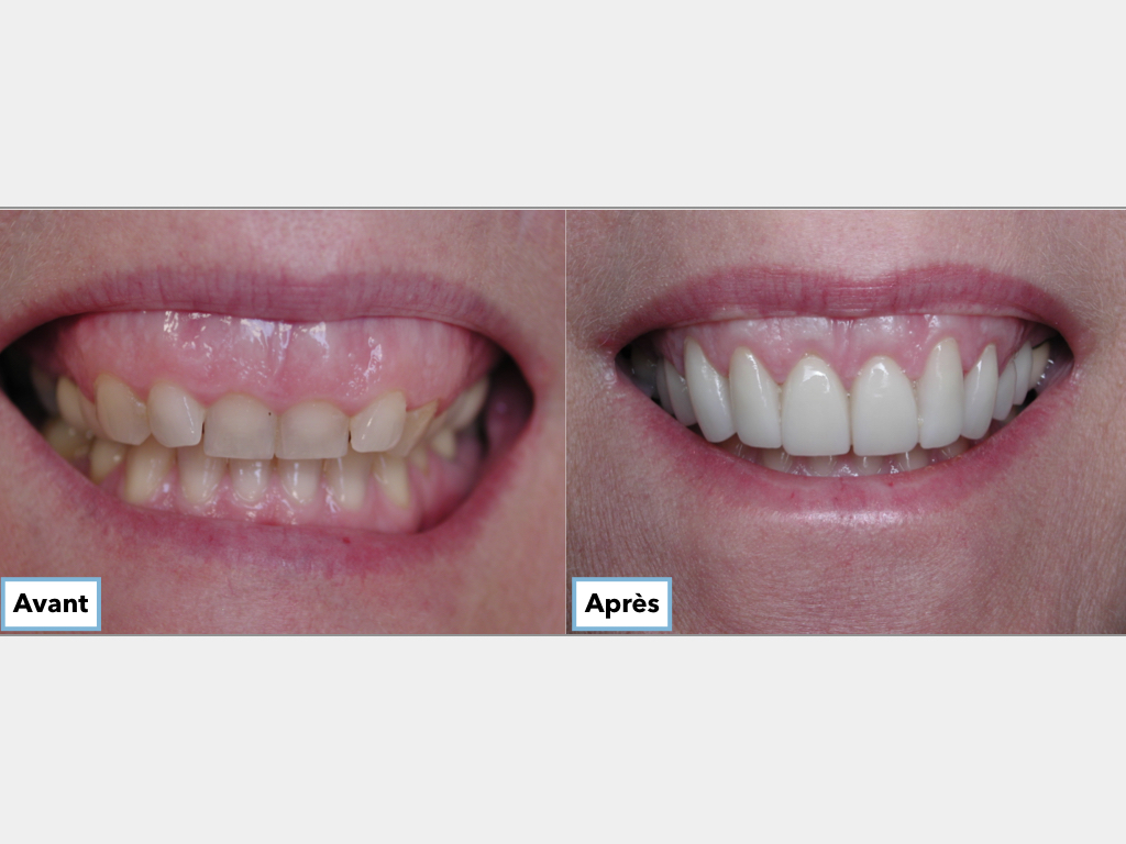 https://clinique-dentaire-solesmes.com/wp-content/uploads/2019/11/un-nouveau-sourire.003.jpeg